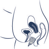 INSERCIÓN